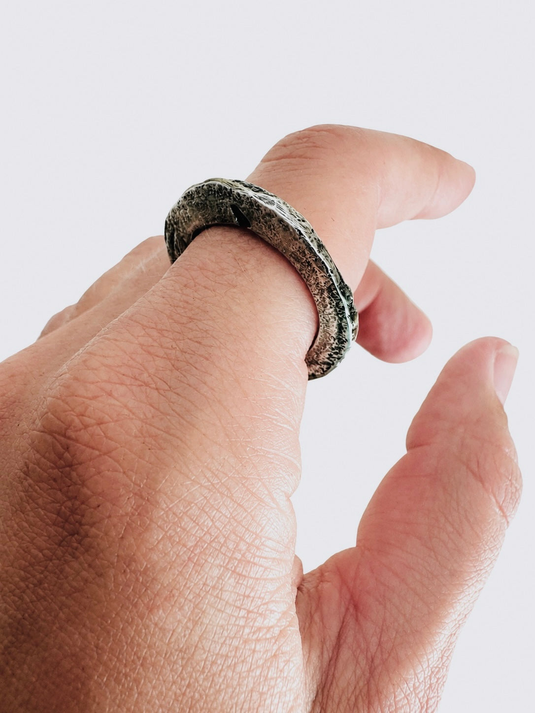 Ring Vein