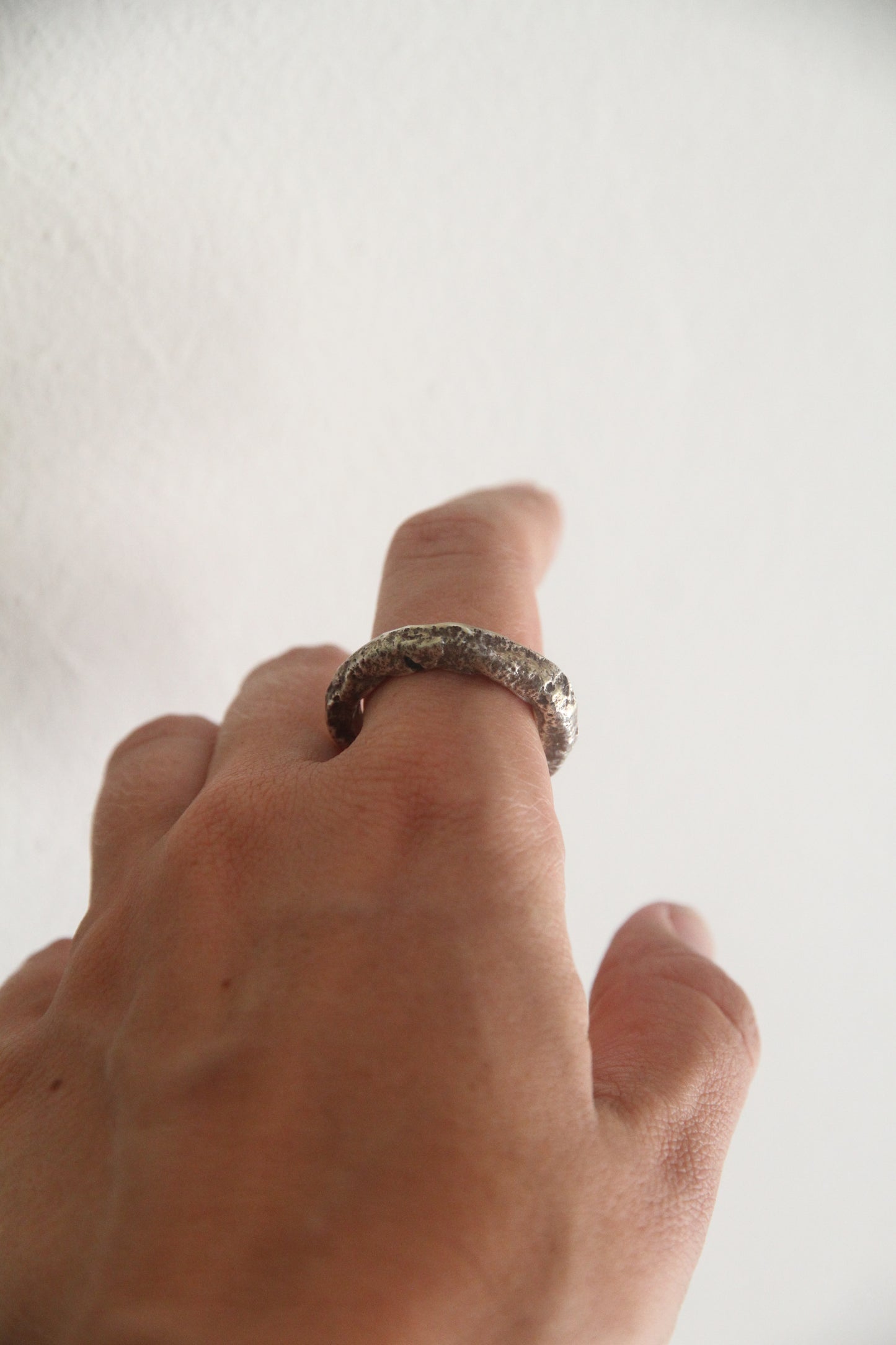 Ring Vein
