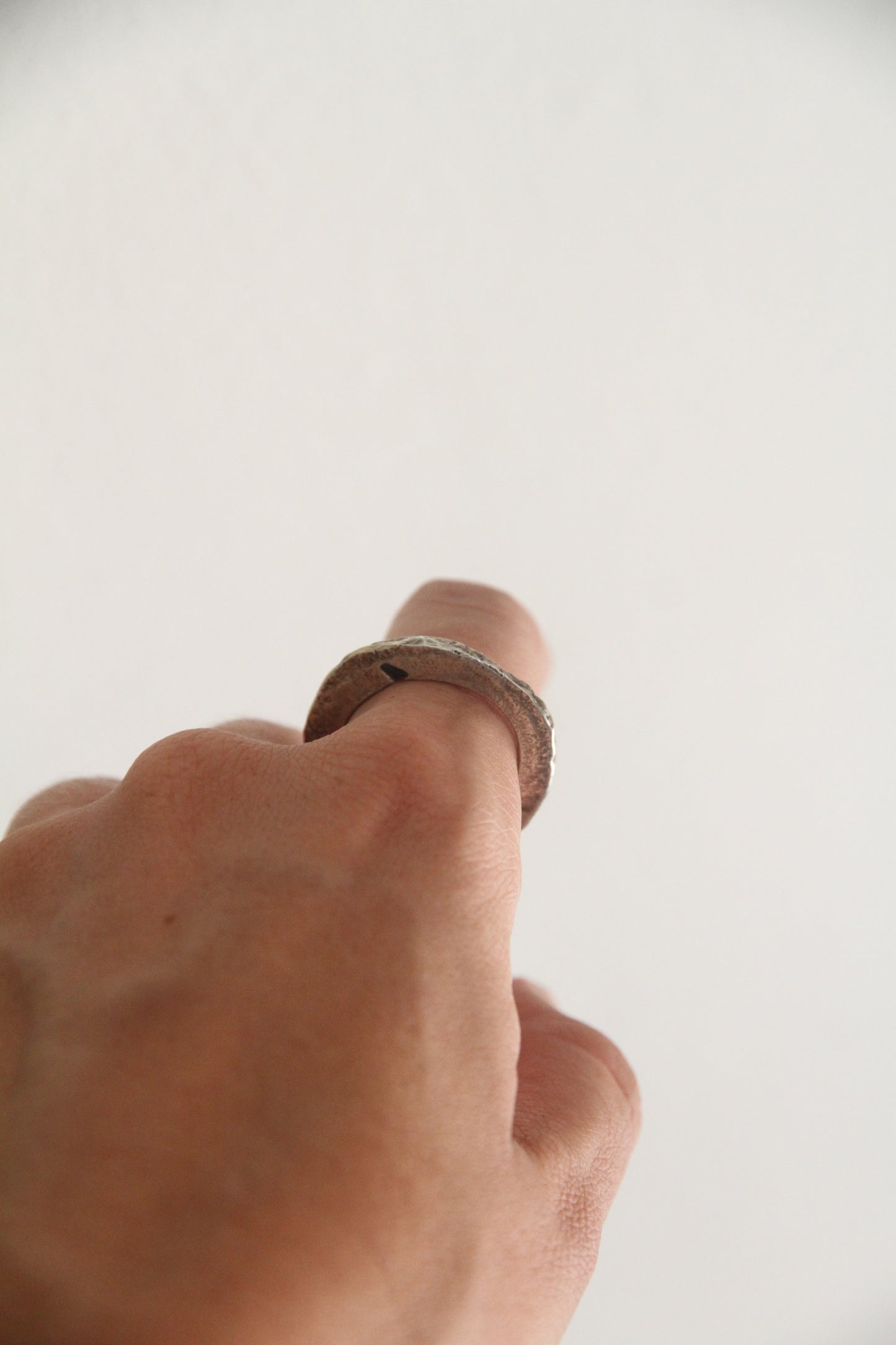 Ring Vein
