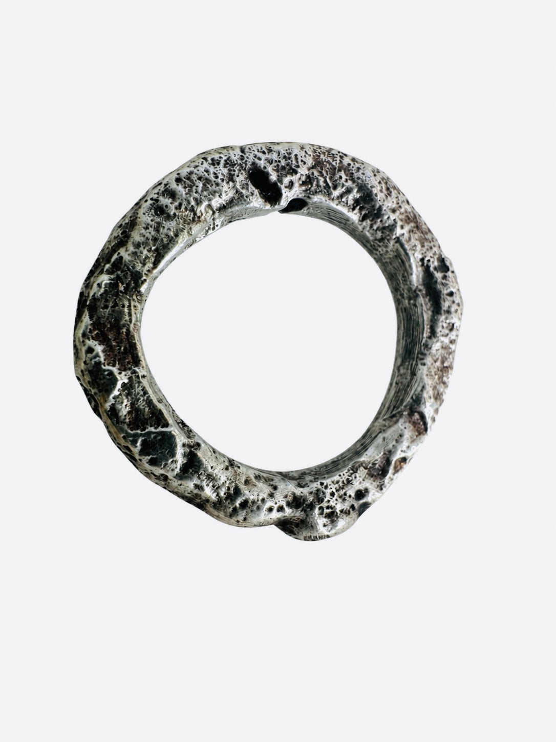 Ring Vein