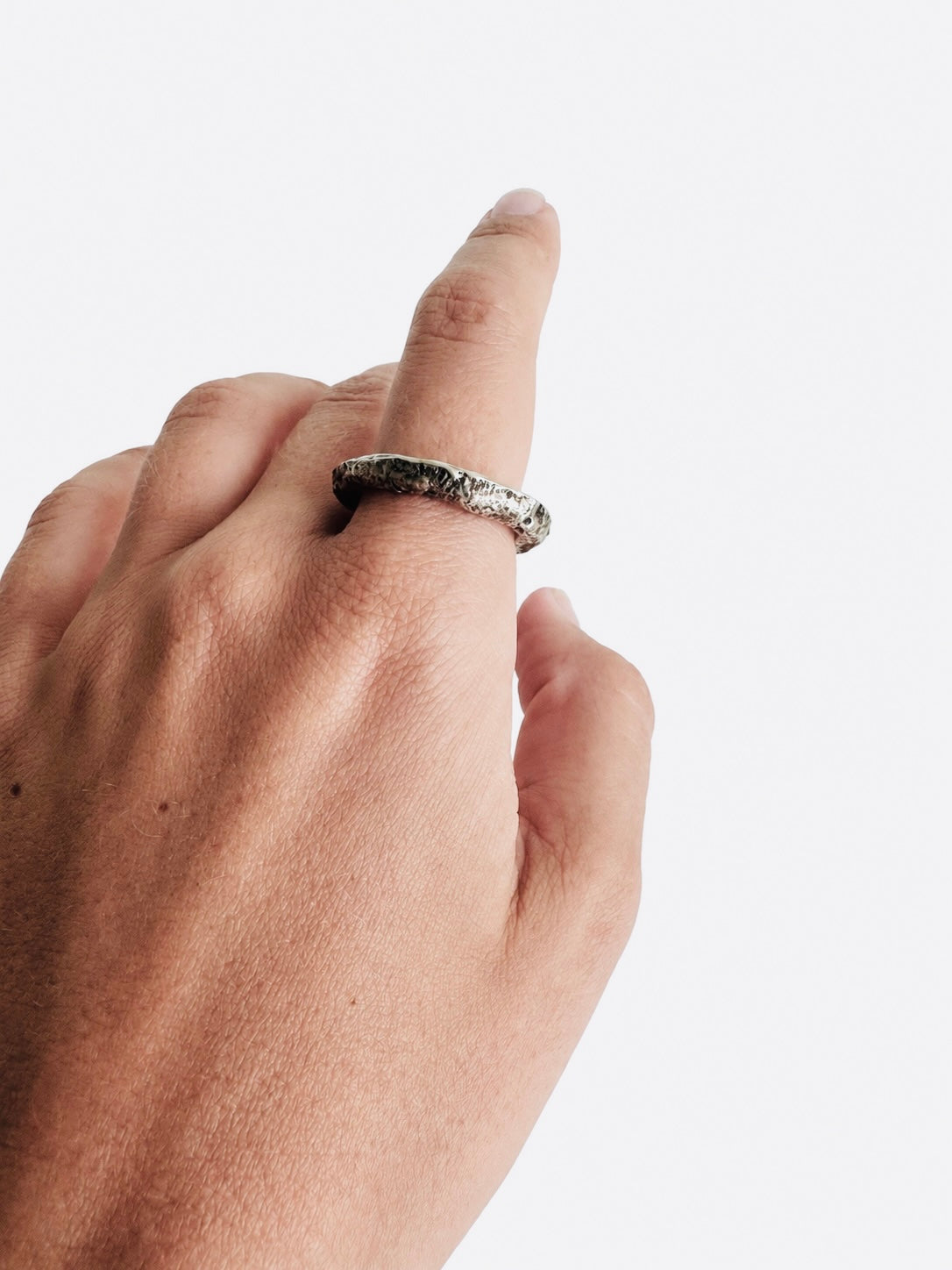 Ring Vein